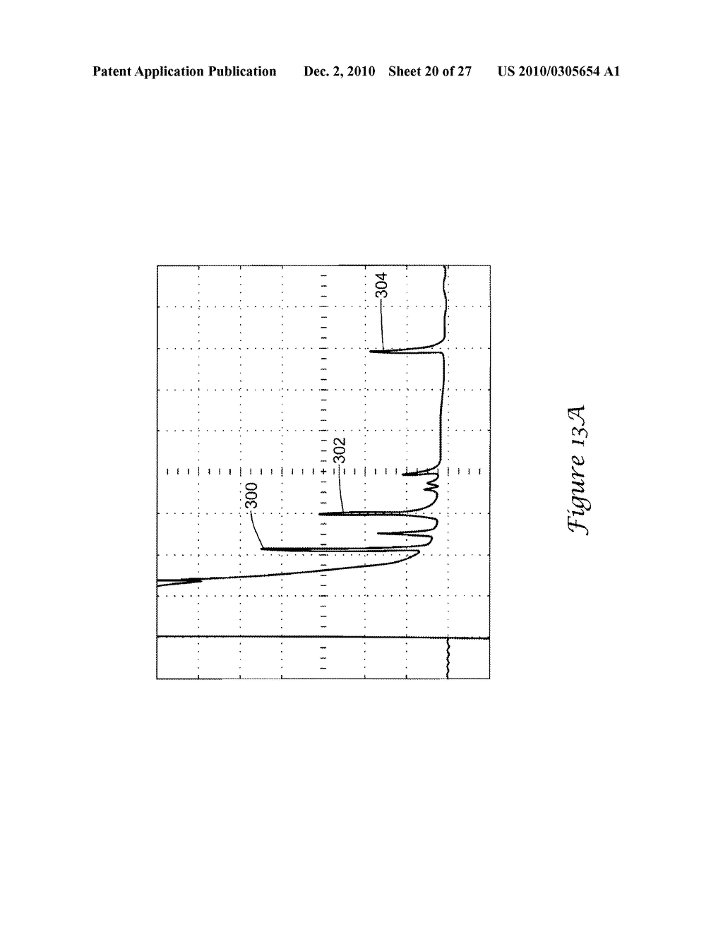 Electromagnetic Interference Shielding in an Implantable Medical Device - diagram, schematic, and image 21