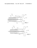 Gastric Simulation Anchor and Method diagram and image