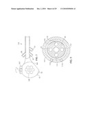 Gastric Simulation Anchor and Method diagram and image