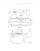 Gastric Simulation Anchor and Method diagram and image