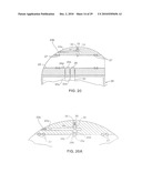 Gastric Simulation Anchor and Method diagram and image