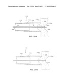 Gastric Simulation Anchor and Method diagram and image