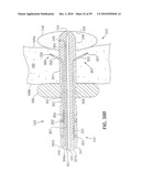 Gastric Simulation Anchor and Method diagram and image