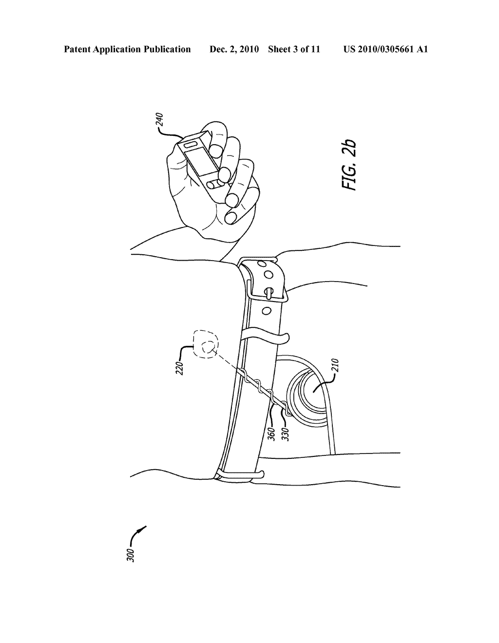 MEDICAL DEVICE ANTENNA SYSTEMS HAVING EXTERNAL ANTENNA CONFIGURATIONS - diagram, schematic, and image 04