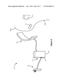 Techniques for Controlling Charging of Batteries in an External Charger and an Implantable Medical Device diagram and image