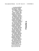 SPECIALLY CONFIGURED AND SURFACE MODIFIED MEDICAL DEVICE WITH CERTAIN DESIGN FEATURES THAT UTILIZE THE INTRINSIC PROPERTIES OF TUNGSTEN, ZIRCONIUM, TANTALUM AND/OR NIOBIUM diagram and image