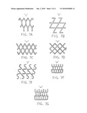 SPECIALLY CONFIGURED AND SURFACE MODIFIED MEDICAL DEVICE WITH CERTAIN DESIGN FEATURES THAT UTILIZE THE INTRINSIC PROPERTIES OF TUNGSTEN, ZIRCONIUM, TANTALUM AND/OR NIOBIUM diagram and image