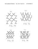 SPECIALLY CONFIGURED AND SURFACE MODIFIED MEDICAL DEVICE WITH CERTAIN DESIGN FEATURES THAT UTILIZE THE INTRINSIC PROPERTIES OF TUNGSTEN, ZIRCONIUM, TANTALUM AND/OR NIOBIUM diagram and image