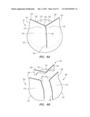 Prosthetic Heart Valves, Scaffolding Structures, and Systems and Methods for Implantation of Same diagram and image