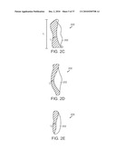 Patient Selectable Knee Joint Arthroplasty Devices diagram and image