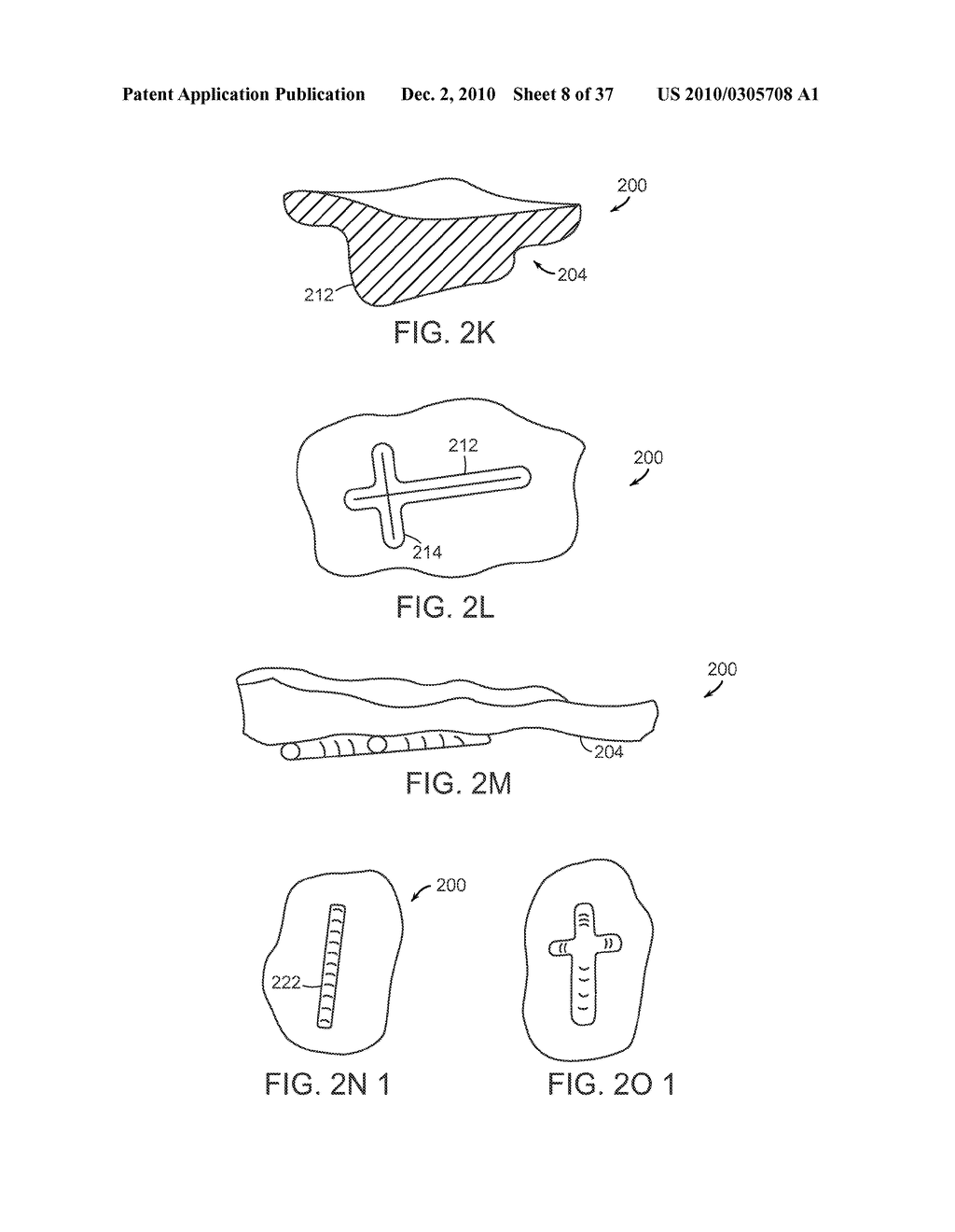 Patient Selectable Knee Joint Arthroplasty Devices - diagram, schematic, and image 09