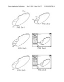 Patient Selectable Knee Joint Arthroplasty Devices diagram and image