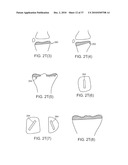 Patient Selectable Knee Joint Arthroplasty Devices diagram and image