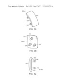 Patient Selectable Knee Joint Arthroplasty Devices diagram and image