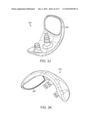 Patient Selectable Knee Joint Arthroplasty Devices diagram and image