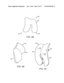 Patient Selectable Knee Joint Arthroplasty Devices diagram and image