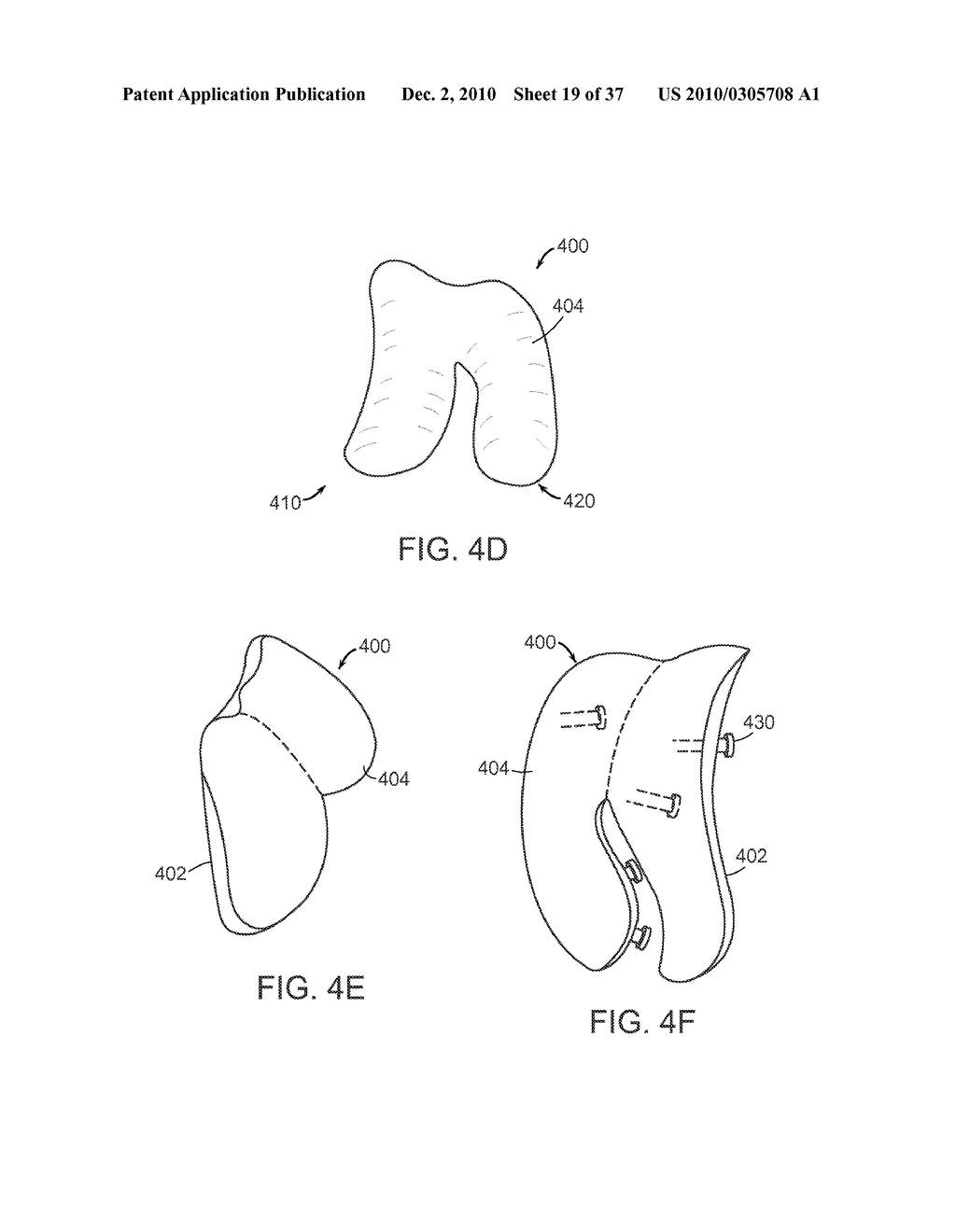 Patient Selectable Knee Joint Arthroplasty Devices - diagram, schematic, and image 20