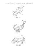 Patient Selectable Knee Joint Arthroplasty Devices diagram and image