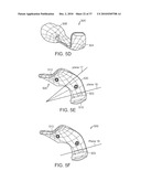 Patient Selectable Knee Joint Arthroplasty Devices diagram and image