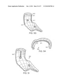 Patient Selectable Knee Joint Arthroplasty Devices diagram and image