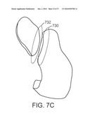 Patient Selectable Knee Joint Arthroplasty Devices diagram and image