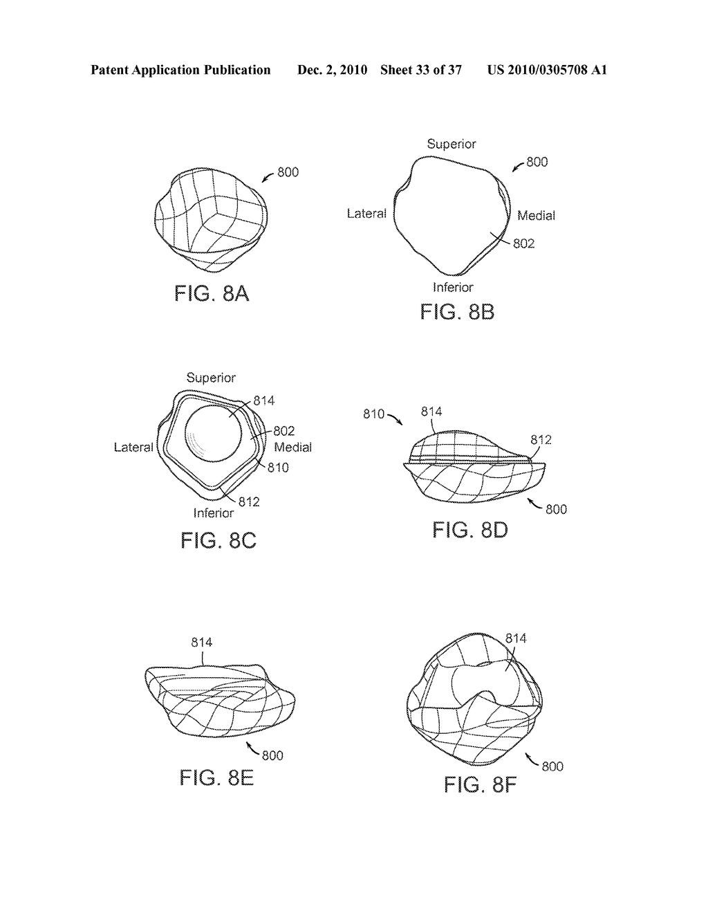 Patient Selectable Knee Joint Arthroplasty Devices - diagram, schematic, and image 34