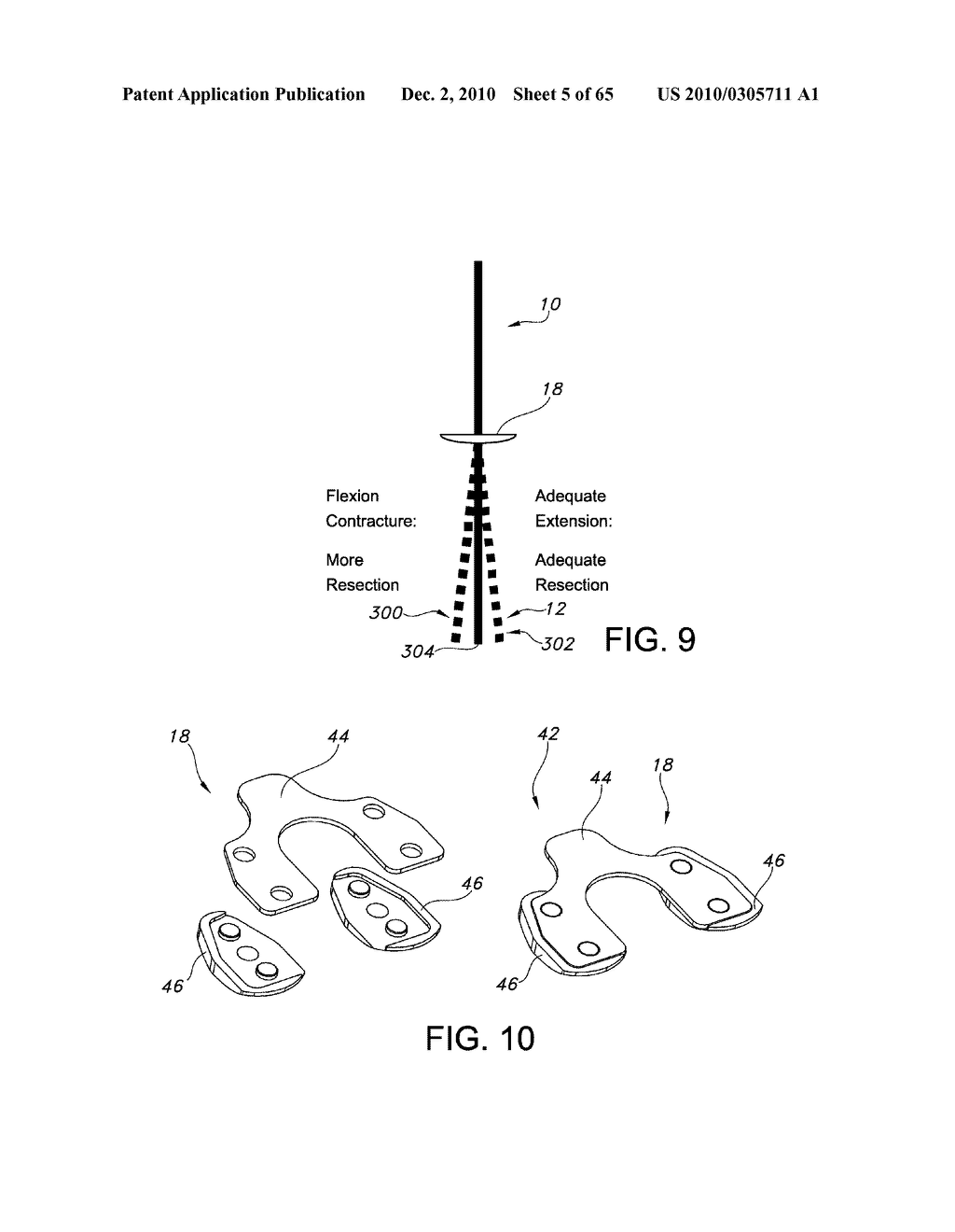 Methods and Apparatus for Performing Knee Arthroplasty - diagram, schematic, and image 06