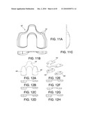 Methods and Apparatus for Performing Knee Arthroplasty diagram and image