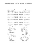 Methods and Apparatus for Performing Knee Arthroplasty diagram and image