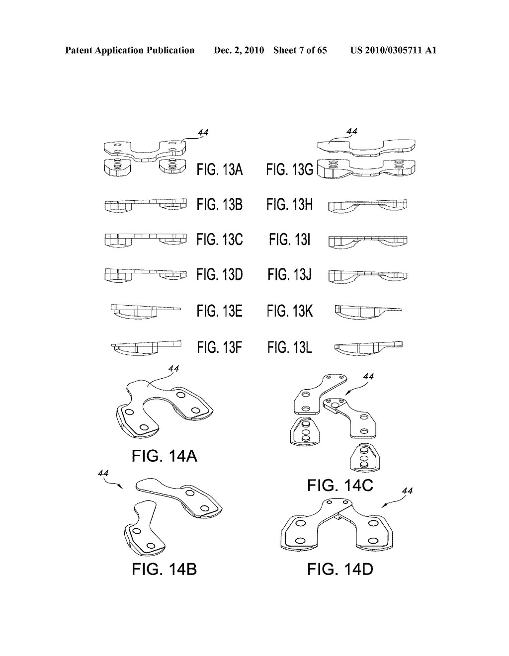 Methods and Apparatus for Performing Knee Arthroplasty - diagram, schematic, and image 08