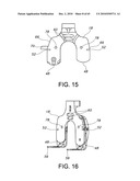 Methods and Apparatus for Performing Knee Arthroplasty diagram and image