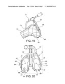 Methods and Apparatus for Performing Knee Arthroplasty diagram and image