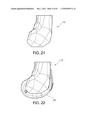 Methods and Apparatus for Performing Knee Arthroplasty diagram and image