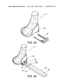 Methods and Apparatus for Performing Knee Arthroplasty diagram and image