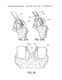 Methods and Apparatus for Performing Knee Arthroplasty diagram and image