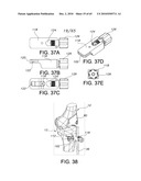 Methods and Apparatus for Performing Knee Arthroplasty diagram and image