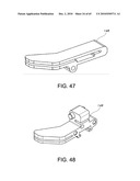 Methods and Apparatus for Performing Knee Arthroplasty diagram and image