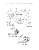 Methods and Apparatus for Performing Knee Arthroplasty diagram and image