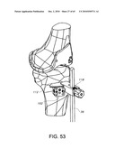 Methods and Apparatus for Performing Knee Arthroplasty diagram and image