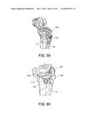 Methods and Apparatus for Performing Knee Arthroplasty diagram and image