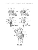 Methods and Apparatus for Performing Knee Arthroplasty diagram and image