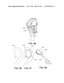 Methods and Apparatus for Performing Knee Arthroplasty diagram and image