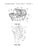 Methods and Apparatus for Performing Knee Arthroplasty diagram and image