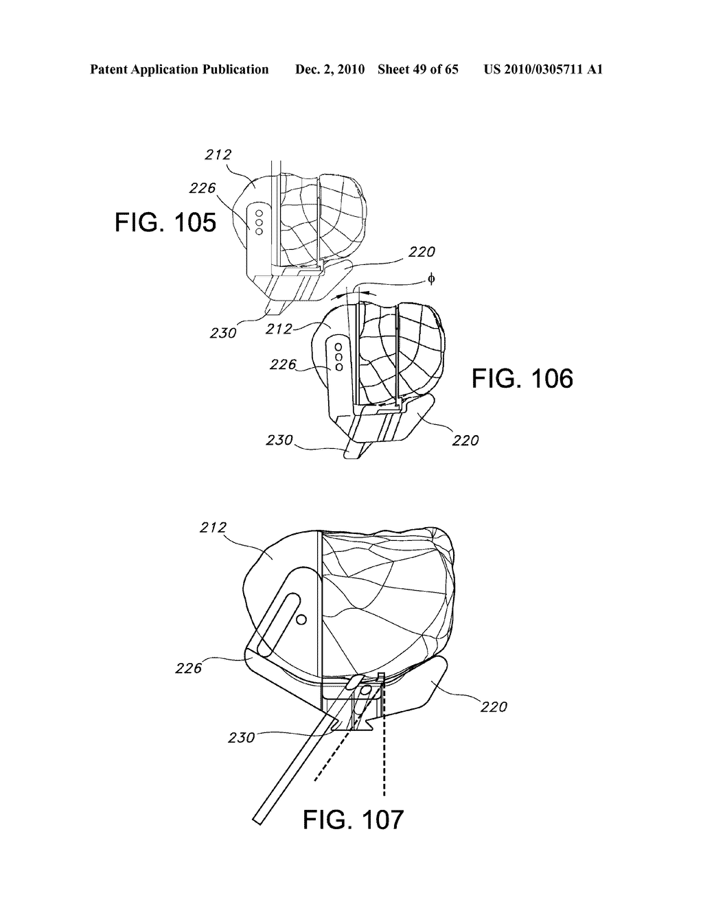 Methods and Apparatus for Performing Knee Arthroplasty - diagram, schematic, and image 50