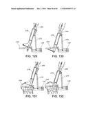 Methods and Apparatus for Performing Knee Arthroplasty diagram and image