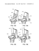 Methods and Apparatus for Performing Knee Arthroplasty diagram and image