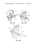 Methods and Apparatus for Performing Knee Arthroplasty diagram and image