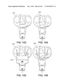 Methods and Apparatus for Performing Knee Arthroplasty diagram and image