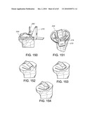 Methods and Apparatus for Performing Knee Arthroplasty diagram and image