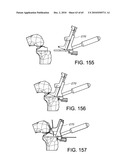 Methods and Apparatus for Performing Knee Arthroplasty diagram and image